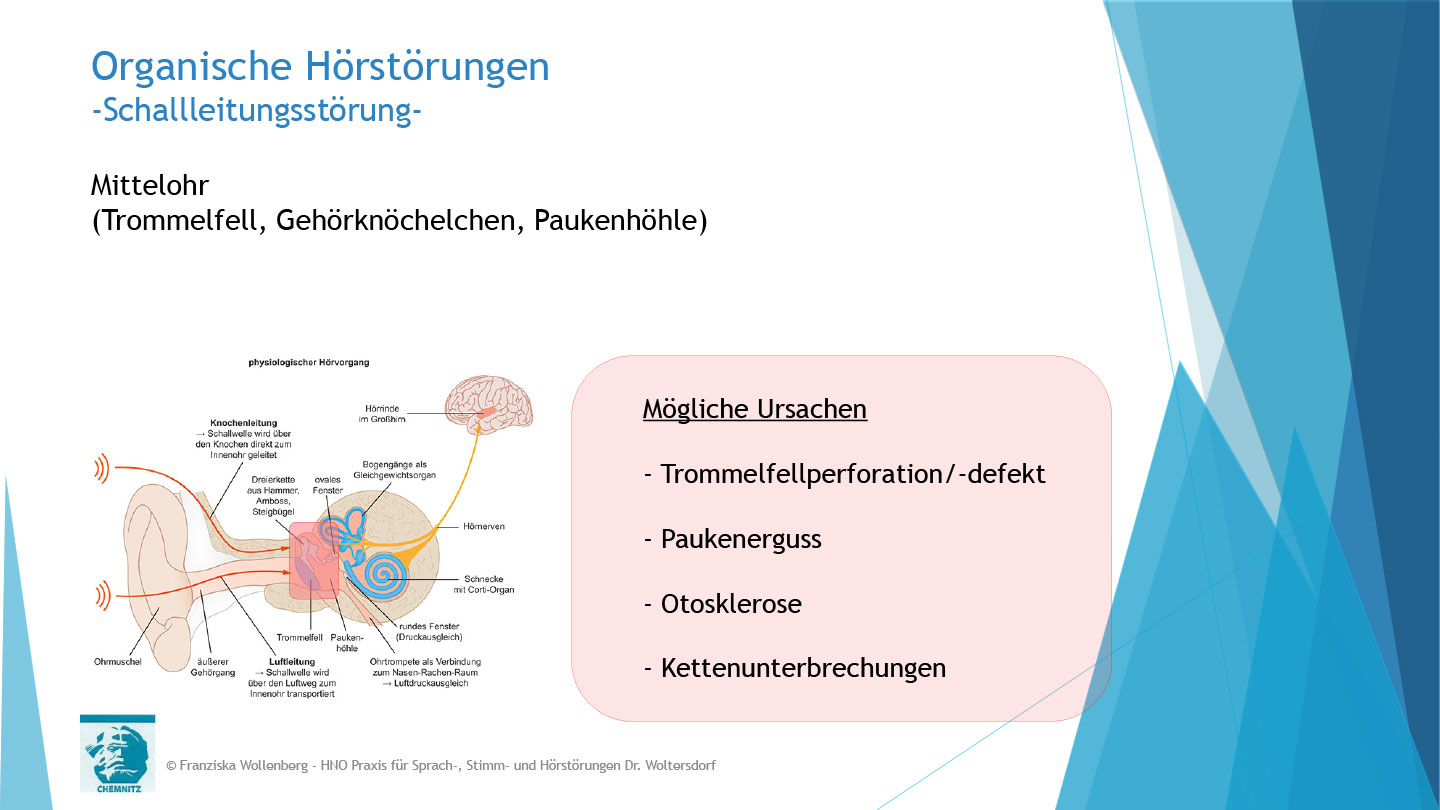 Das Hören . AVWS-Fachvortrag . Franziska Wollenberg