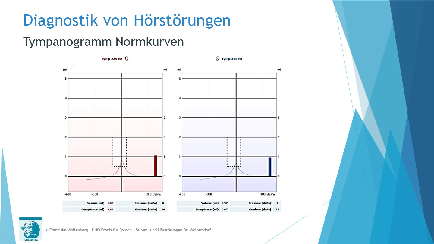 Das Hören . AVWS-Fachvortrag . Franziska Wollenberg