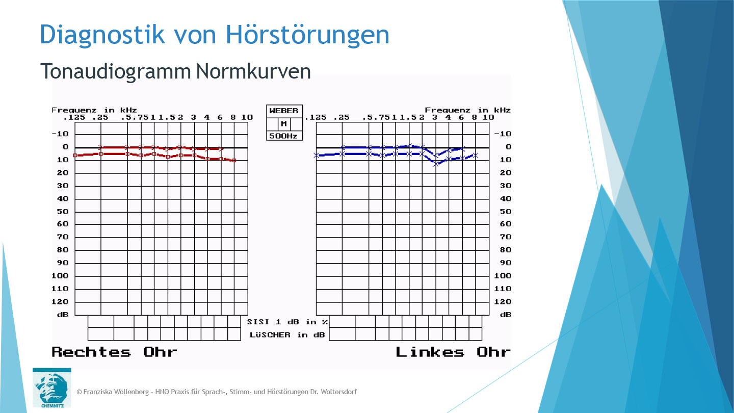 Das Hören . AVWS-Fachvortrag . Franziska Wollenberg