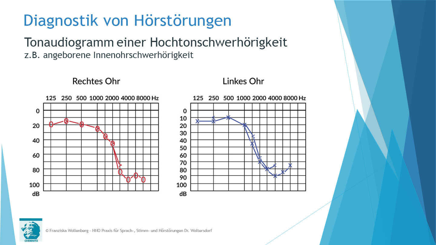Das Hören . AVWS-Fachvortrag . Franziska Wollenberg