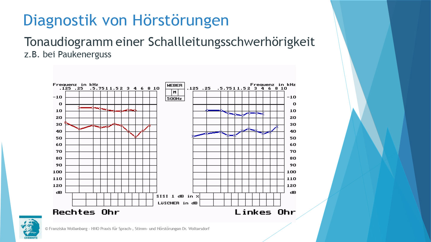 Das Hören . AVWS-Fachvortrag . Franziska Wollenberg