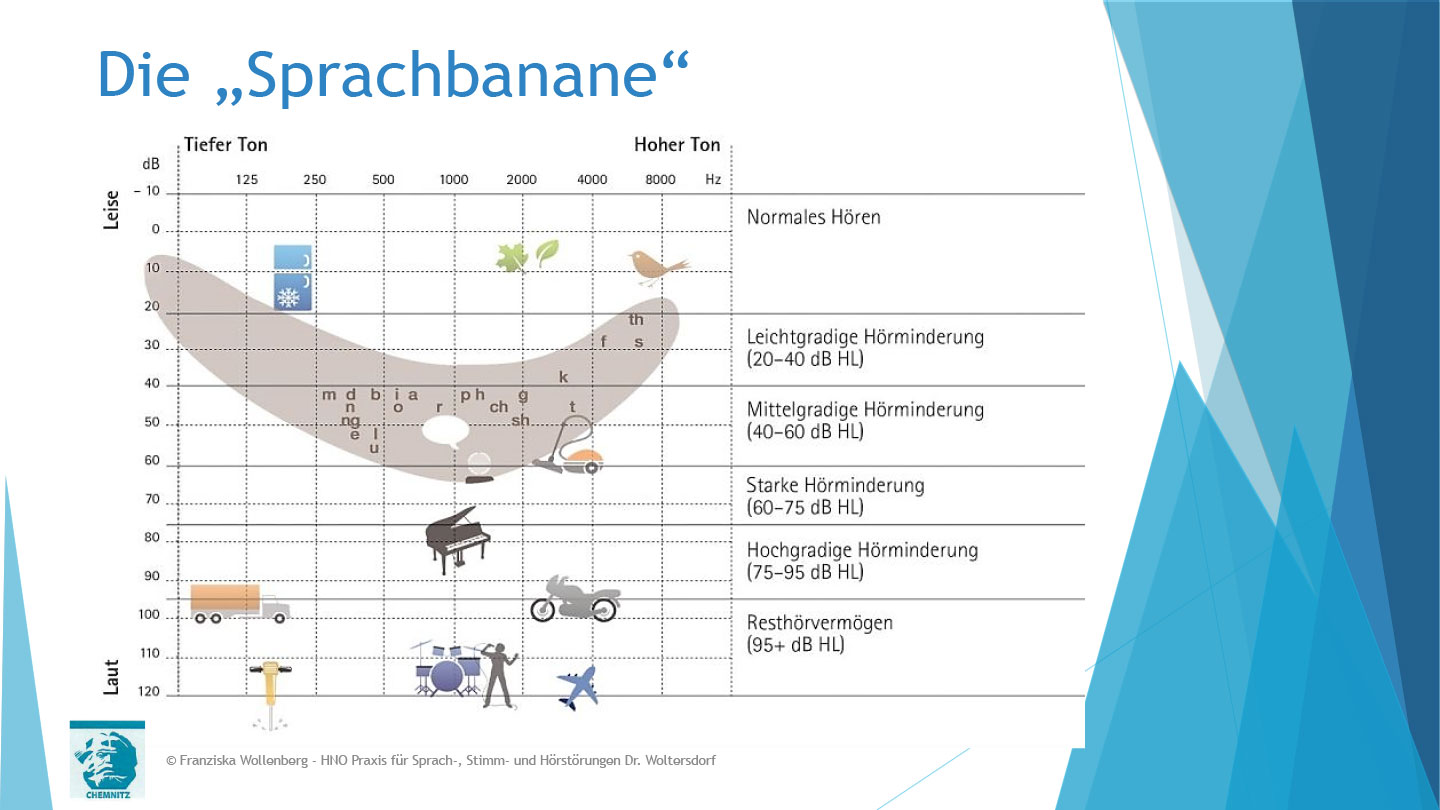 Das Hören . AVWS-Fachvortrag . Franziska Wollenberg
