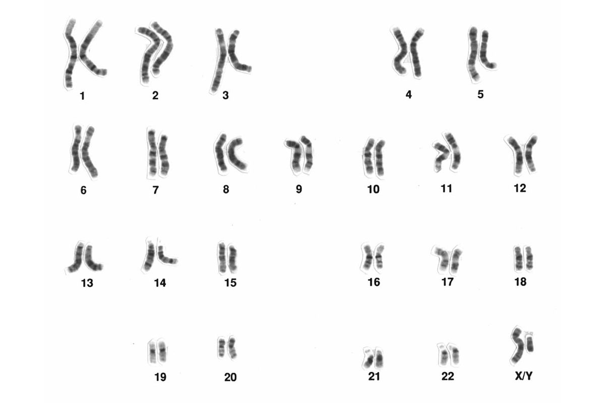 Normaler Karyotyp eines Mannes: technisch gebänderte Metaphase-Chromosomen (46,XY) (National Human Genome Research Institute, USA)