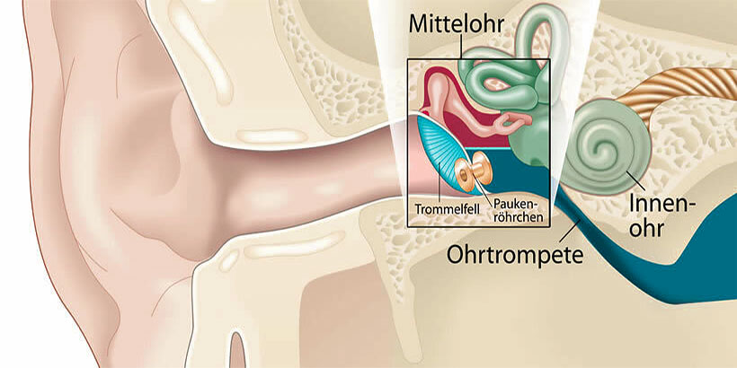 Paukenröhrchen (schematische Darstellung)