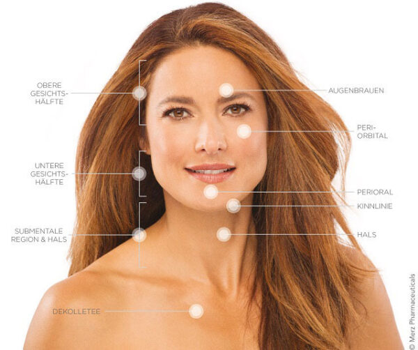 Merz Aesthetics Ultherapy®: Behandlungs-Areale